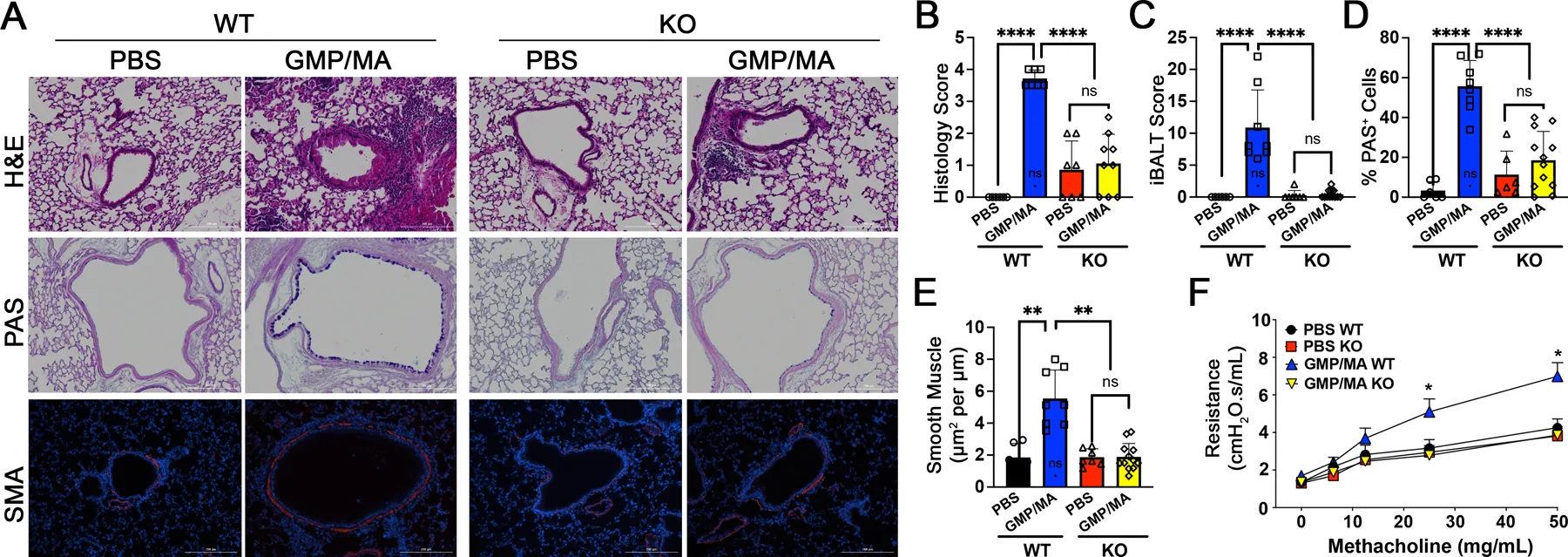 Surfactant Protein D Influences Mortality During Abdominal Sepsis by Facilitating