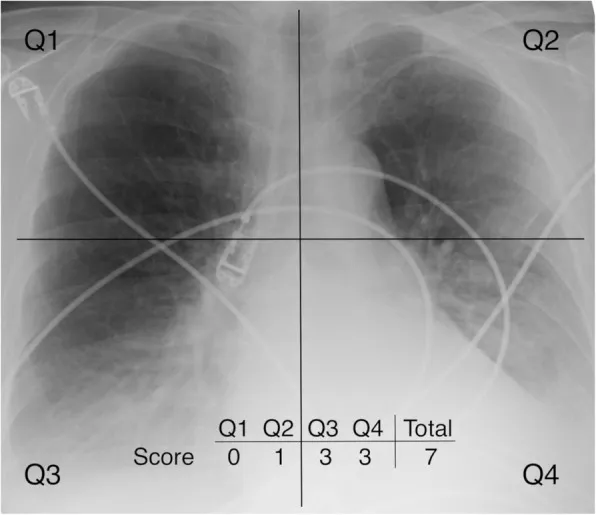 Update in Critical Care 2019.