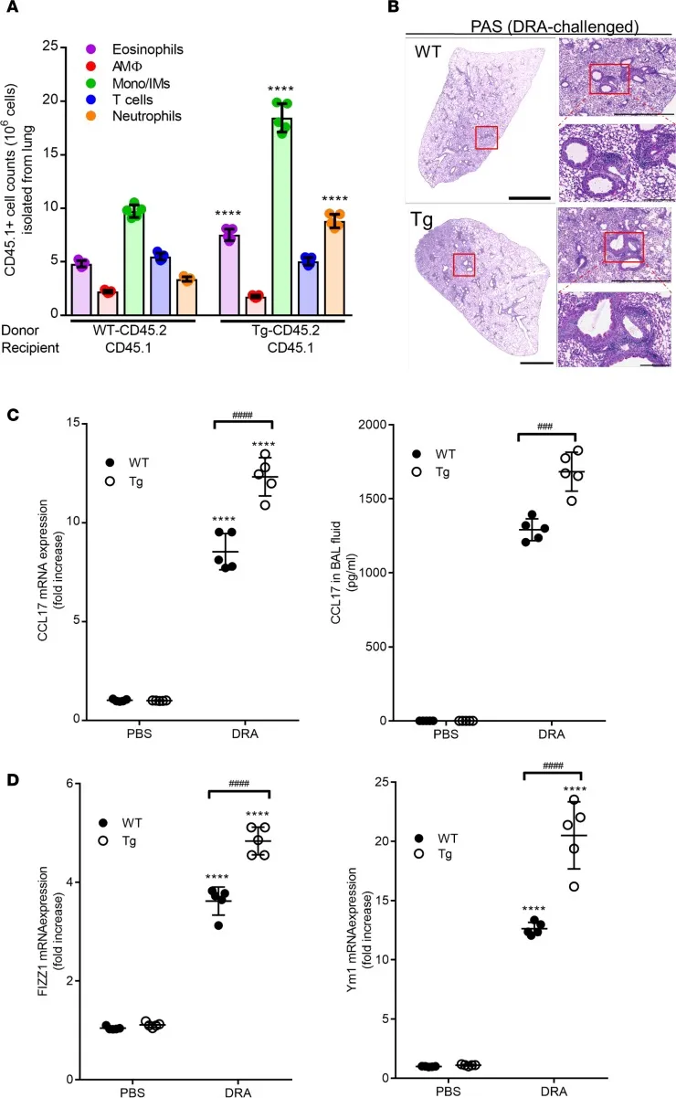 Early Neuromuscular Blockade in the Acute Respiratory Distress Syndrome.