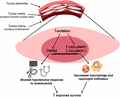 Integrating molecular pathogenesis and clinical translation in sepsis-induced acute respiratory distress syndrome.