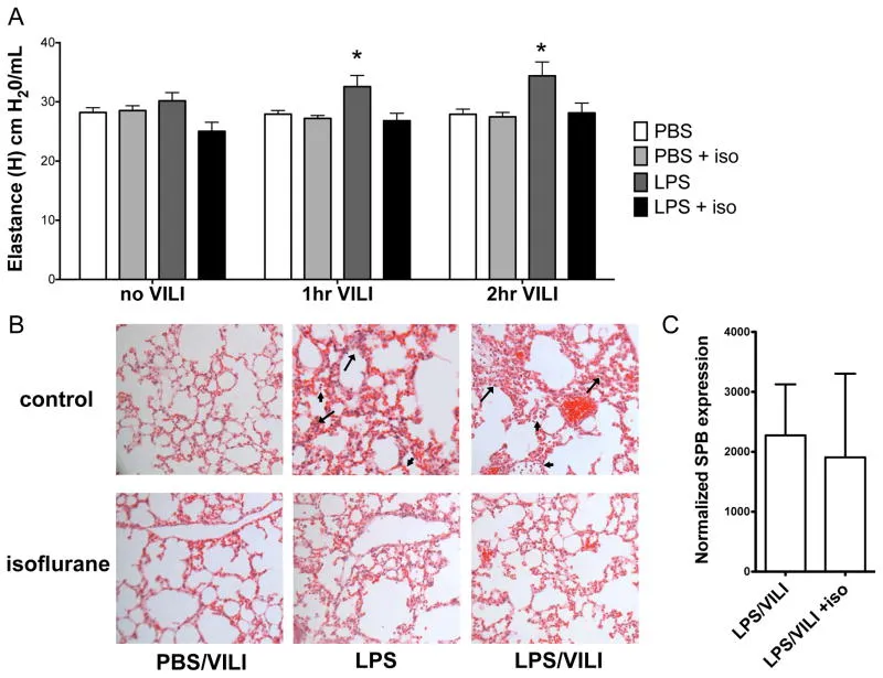 Mesenchymal Stromal Cells Deficient in Autophagy Proteins Are Susceptible to Oxidative Injury and Mitochondrial Dysfunction.